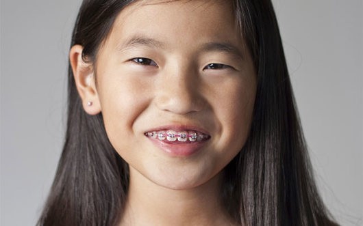 Girl with braces